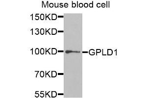 Western blot analysis of extracts of mouse blood, using GPLD1 antibody (ABIN5973975) at 1/1000 dilution. (GPLD1 抗体)