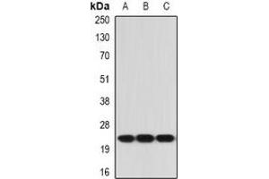 Western blot analysis of IL-21 expression in mouse testis (A), mouse liver (B), mouse skin (C) whole cell lysates.