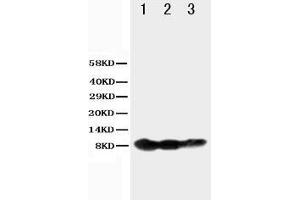 Anti-BAFF Receptor antibody, Western blotting Lane 1: Recombinant Human BAFFR Protein 10ng Lane 2: Recombinant Human BAFFR Protein 5ng Lane 3: Recombinant Human BAFFR Protein 2. (TNFRSF13C 抗体  (N-Term))