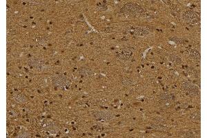 ABIN6276382 at 1/100 staining Rat brain tissue by IHC-P. (TCL1A 抗体  (Internal Region))