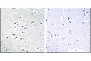 Immunohistochemistry analysis of paraffin-embedded human brain tissue, using ZEB2 Antibody. (ZEB2 抗体  (AA 71-120))