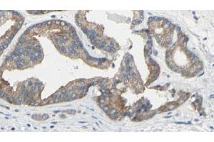 ABIN6269186 at 1/100 staining Human prostate tissue by IHC-P. (TNNI3 抗体  (N-Term))