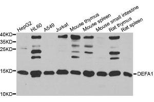 Western blot analysis of extracts of various cell lines, using DEFA1 antibody. (alpha Defensin 1 抗体  (AA 1-94))