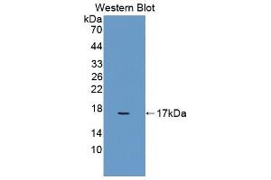 Western blot analysis of the recombinant protein. (Glucose-6-Phosphate Dehydrogenase 抗体  (AA 258-350))