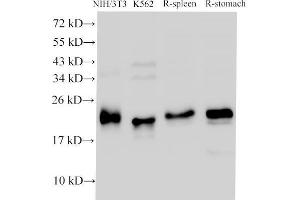 Western Blot analysis of NIH/3T3, K562 cells, Rat spleen and Rat stomach using CDK4 Polyclonal Antibody at dilution of 1:1000 (CDK4 抗体)