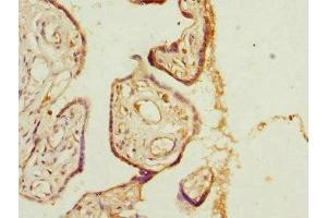 Immunohistochemistry (IHC) image for anti-Pleckstrin Homology-Like Domain, Family A, Member 2 (PHLDA2) (AA 1-152) antibody (ABIN7163670)