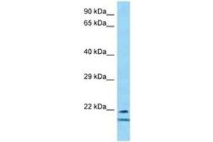 TCF23 抗体  (AA 92-141)