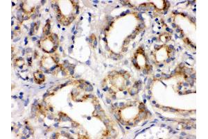 Immunohistochemistry (Paraffin-embedded Sections) (IHC (p)) image for anti-Frizzled Family Receptor 1 (Fzd1) (AA 369-400), (C-Term) antibody (ABIN3042412) (FZD1 抗体  (C-Term))