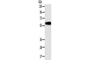 Western Blotting (WB) image for anti-Perilipin 1 (PLIN1) antibody (ABIN2435178) (PLIN1 抗体)