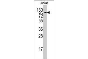 Western blot analysis of ADCY2 polyclonal antibody  in Jurkat cell line lysates (35 ug/lane).