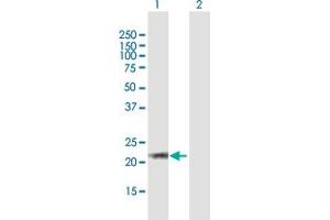 Western Blot analysis of ARL6 expression in transfected 293T cell line by ARL6 MaxPab polyclonal antibody. (ARL6 抗体  (AA 1-186))