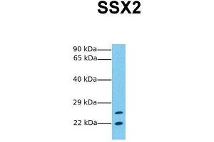 Host:  Rabbit  Target Name:  SSX2  Sample Tissue:  Human Jurkat  Antibody Dilution:  1. (SSX2 抗体  (C-Term))