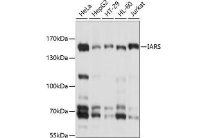 Western blot analysis of extracts of various cell lines, using IARS antibody (ABIN6132301, ABIN6142113, ABIN6142114 and ABIN6214344) at 1:1000 dilution. (IARS 抗体  (AA 1158-1262))