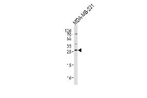 Western blot analysis of lysate from MDA-MB-231 cell line, using CRISP1 Antibody at 1:1000 at each lane. (CRISP1 抗体  (C-Term))
