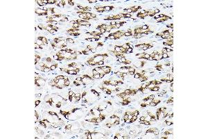 Immunohistochemistry (IHC) image for anti-Solute Carrier Family 8 (Sodium/calcium Exchanger), Member 1 (SLC8A1) (AA 250-520) antibody (ABIN6148050)