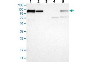Western blot analysis of Lane 1: RT-4, Lane 2: U-251 MG, Lane 3: Human Plasma, Lane 4: Liver, Lane 5: Tonsil with NFKB2 polyclonal antibody  at 1:250-1:500 dilution. (NFKB2 抗体)