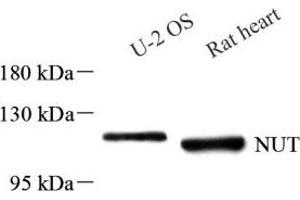 Western blot analysis of NUT (ABIN7074932) at dilution of 1: 1000 (NUT 抗体)