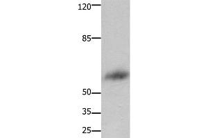 Western Blot analysis of Human liver cancer tissue using FOXJ3 Polyclonal Antibody at dilution of 1:800 (FOXJ3 抗体)