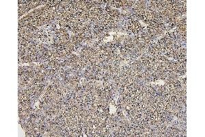 IHC analysis of ALDOB using anti-ALDOB antibody (ABIN7602563). (ALDOB 抗体  (AA 85-364))