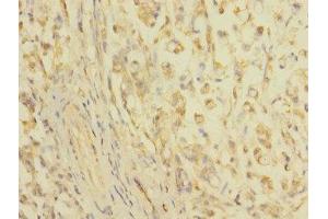 Immunohistochemistry (IHC) image for anti-Claudin 18 (CLDN18) (AA 20-80) antibody (ABIN6038124) (Claudin 18 抗体  (AA 20-80))