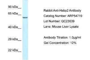 Western Blotting (WB) image for anti-Hyaluronan Binding Protein 2 (HABP2) (C-Term) antibody (ABIN2785850)