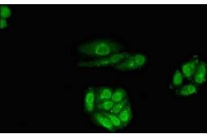Immunofluorescent analysis of HepG2 cells using ABIN7167799 at dilution of 1:100 and Alexa Fluor 488-congugated AffiniPure Goat Anti-Rabbit IgG(H+L) (Retinoic Acid Receptor beta 抗体  (AA 1-85))