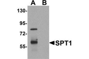 Western blot analysis of TYW3 in A549 cell lysate with TYW3 antibody at 1 μg/ml in (A) the absence and (B) the presence of blocking peptide. (TYW3 抗体  (Center))