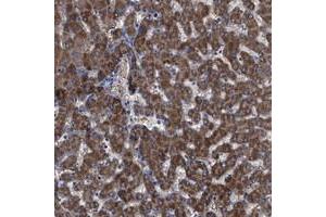 Immunohistochemical staining of human liver with GPR179 polyclonal antibody  shows distinct cytoplasmic positivity in hepatocytes at 1:200-1:500 dilution. (GPR179 抗体)