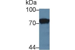Detection of F1+2 in Rat Kidney lysate using Polyclonal Antibody to Prothrombin Fragment 1+2 (F1+2) (Prothrombin Fragment 1+2 抗体  (AA 44-323))