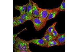 Immunocytochemistry (ICC) image for anti-Progesterone Receptor Membrane Component 1 (PGRMC1) (AA 1-195) antibody (ABIN5873919) (PGRMC1 抗体  (AA 1-195))