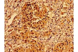 Immunohistochemistry of paraffin-embedded human adrenal gland tissue using ABIN7143732 at dilution of 1:100 (AAGAB 抗体  (AA 191-315))