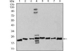 Western blot analysis using RAN mouse mAb against Hela (1), NIH/3T3 (2), A431 (3), C6 (4), Jurkat (5), Hela (6), COS7 (7), and Jurkat (8) cell lysate. (RAN 抗体  (AA 1-216))