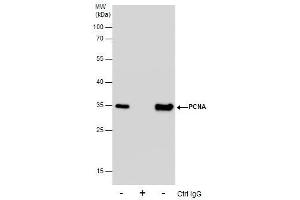 Immunoprecipitation (IP) image for anti-Proliferating Cell Nuclear Antigen (PCNA) antibody (ABIN2854788)