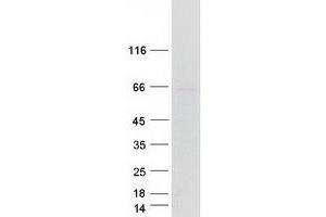 Arylsulfatase D Protein (ARSD) (Transcript Variant 1) (Myc-DYKDDDDK Tag)