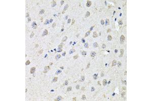 Immunohistochemistry of paraffin-embedded mouse brain using CHCHD3 antibody (ABIN5995784) at dilution of 1/100 (40x lens). (CHCHD3 抗体)