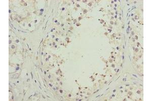 Immunohistochemistry of paraffin-embedded human testis tissue using ABIN7170448 at dilution of 1:100 (SPACA1 抗体  (AA 30-221))