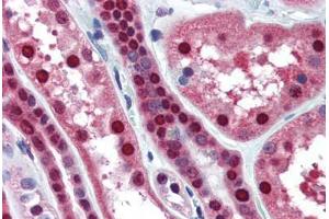 Human Kidney (formalin-fixed, paraffin-embedded) stained with MAT2A antibody ABIN364446 at 10 ug/ml followed by biotinylated anti-mouse IgG secondary antibody ABIN481714, alkaline phosphatase-streptavidin and chromogen. (MAT2A 抗体  (AA 1-395))