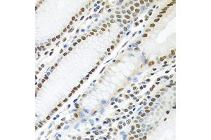 Immunohistochemistry of paraffin-embedded human stomach using PTBP1 antibody (ABIN5995415) at dilution of 1/100 (40x lens). (PTBP1 抗体)