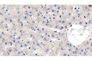 Detection of FGF23 in Human Liver Tissue using Polyclonal Antibody to Fibroblast Growth Factor 23 (FGF23) (FGF23 抗体  (AA 79-160))