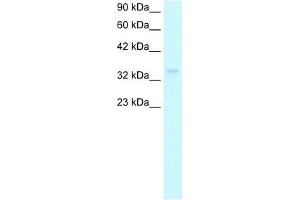 WB Suggested Anti-NPM1 Antibody Titration:  1. (NPM1 抗体  (Middle Region))