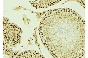 ABIN6276866 at 1/100 staining Mouse testis tissue by IHC-P. (AIRE 抗体  (Internal Region))