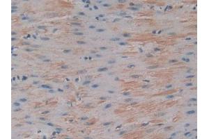 DAB staining on IHC-P; Samples: Mouse Stomach Tissue (IGFBP6 抗体  (AA 46-238))