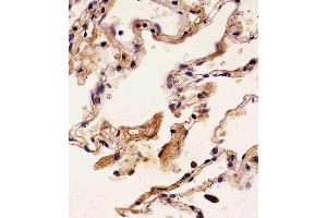 Paraformaldehyde-fixed, paraffin embedded human lung tissue, Antigen retrieval by boiling in sodium citrate buffer (pH6. (S100A2 抗体)