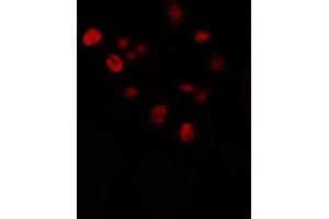 ABIN6274336 staining Hela cells by IF/ICC. (KLF 抗体)