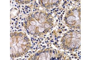 Immunohistochemistry of paraffin-embedded Human colon using ARRB2 Polyclonal Antibody at dilution of 1:200 (40x lens).