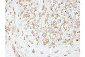 Immunohistochemistry (IHC) image for anti-Activated RNA Polymerase II Transcriptional Coactivator p15 (SUB1) (AA 77-127) antibody (ABIN7448719) (SUB1 抗体  (AA 77-127))
