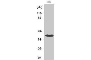Western Blotting (WB) image for anti-Protein Phosphatase, Mg2+/Mn2+ Dependent, 1K (PPM1K) (Internal Region) antibody (ABIN3186534) (PPM1K 抗体  (Internal Region))
