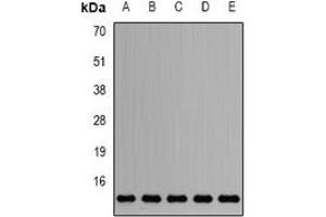 Western blot analysis of Sm-D2 expression in HepG2 (A), Jurkat (B), mouse testis (C), mouse heart (D), rat brain (E) whole cell lysates. (SNRPD2 抗体)