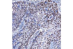 IHC analysis of SF3A1 using anti-SF3A1 antibody (ABIN7600556). (SF3A1 抗体  (AA 20-556))