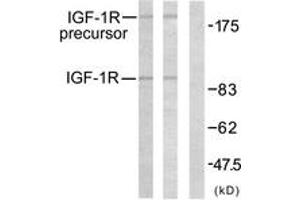 Western blot analysis of extracts from 293 cells, treated with Insulin, using IGF1R (Ab-1161) Antibody. (IGF1R 抗体  (AA 1126-1175))
